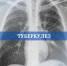 Tuberkulez_5_ - Газета Восход